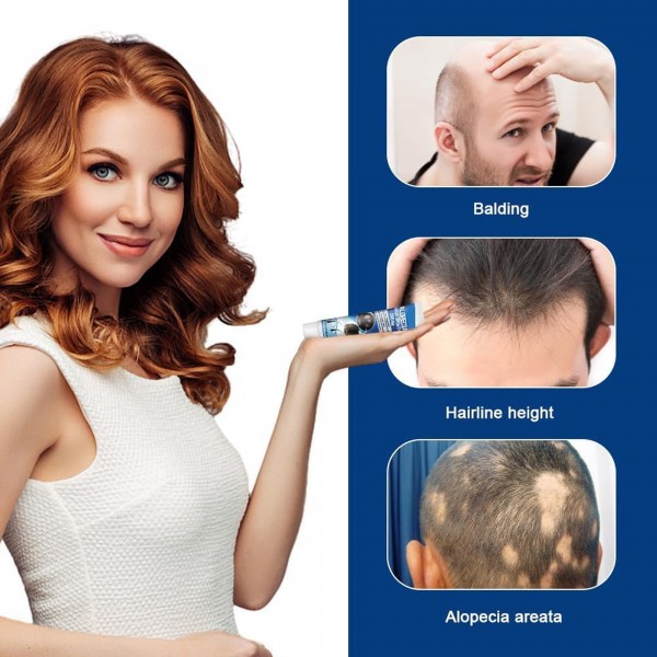 كريم لعلاج داء الثعلبة, 20 جرام من Sumifun