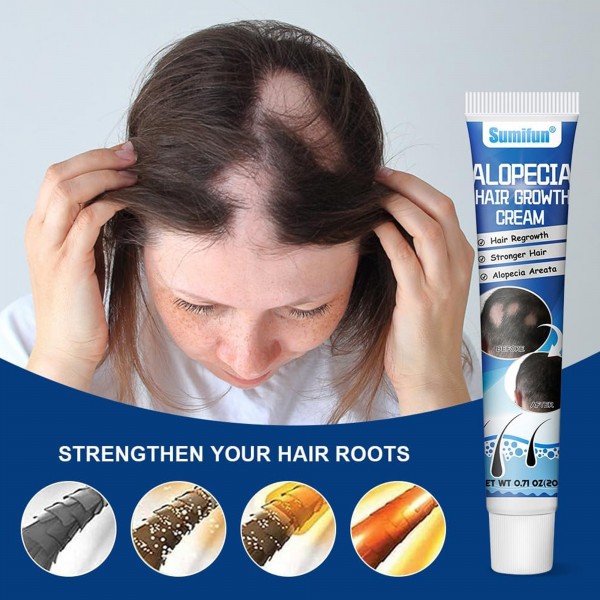 كريم لعلاج داء الثعلبة, 20 جرام من Sumifun