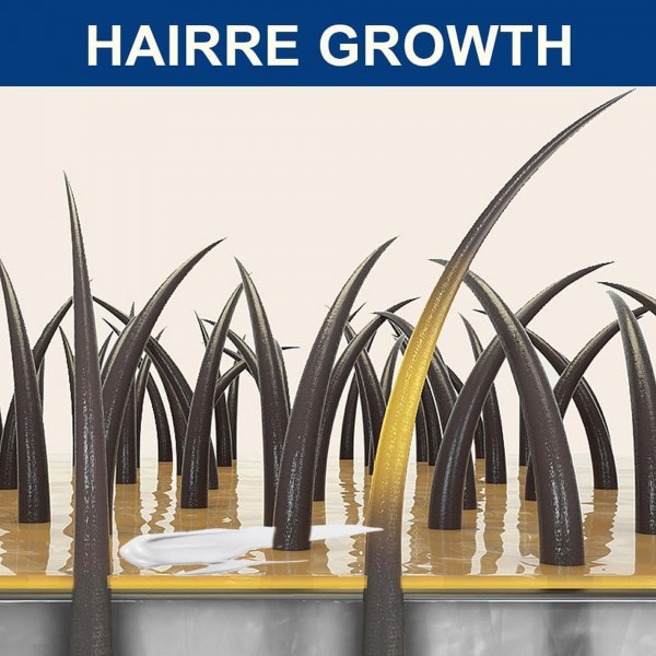 كريم لعلاج داء الثعلبة, 20 جرام من Sumifun