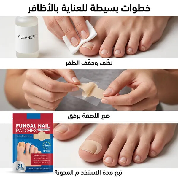 لصقات هيدروجيل لعلاج أظافر القدمين