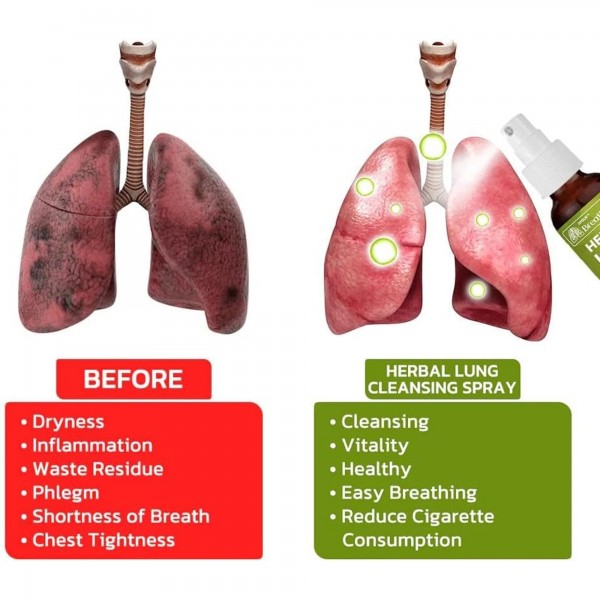 بخاخ عشبي لتنظيف الرئة