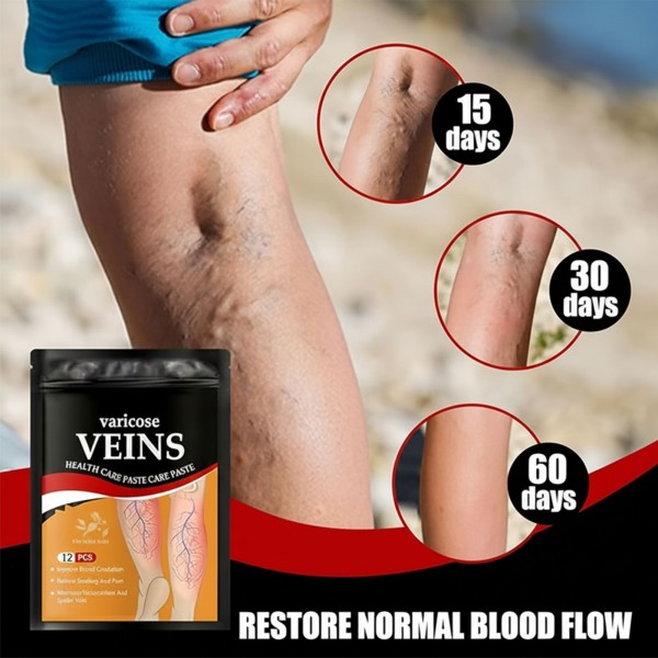 لاصقة وريدية عشبية لتنشيط الدم وإزالة الدوالي