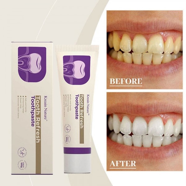 المعجون التريندي الطبيعي لتفتيح الأسنان و ازالة البلاك و انعاش رائحة الفم