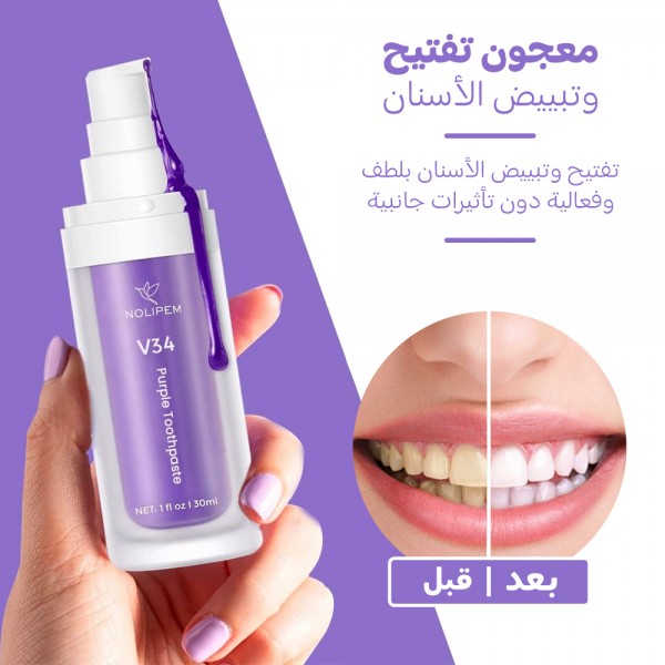 جيل تبييض وتنظيف الاسنان السحري