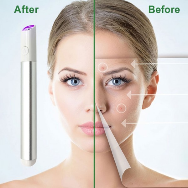 قلم ليزر محمول لإزالة الشامات والجلد الزائد وتصحيح عيوب البشرة