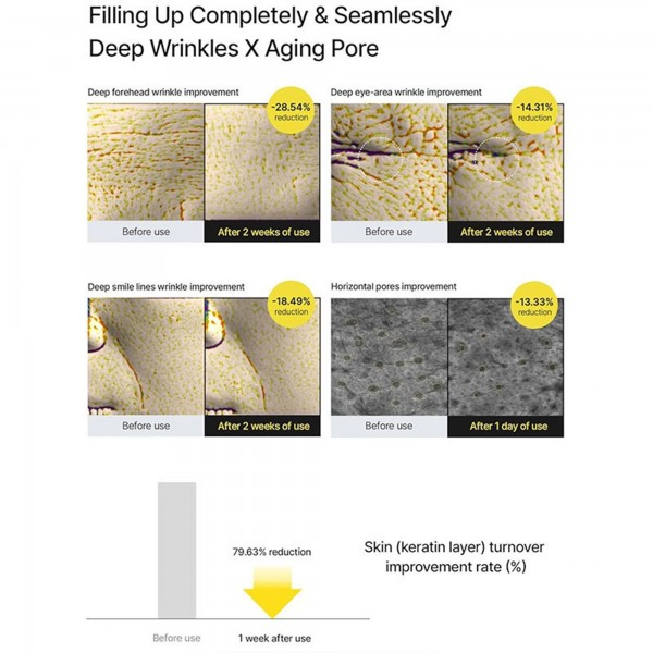 كريم ريتينال بديل البوتوكس لشد البشرة 15 مل