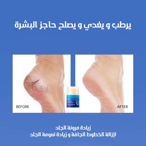 ستيك مرطب لليدين والقدمين- أزرق