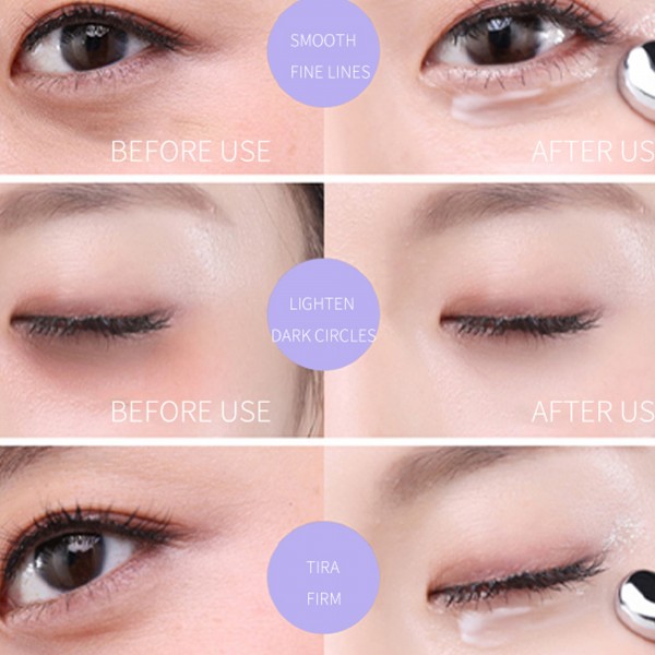 كريم العيون المعجزة لإزالة الهالات وشدّ التجاعيد فورًا