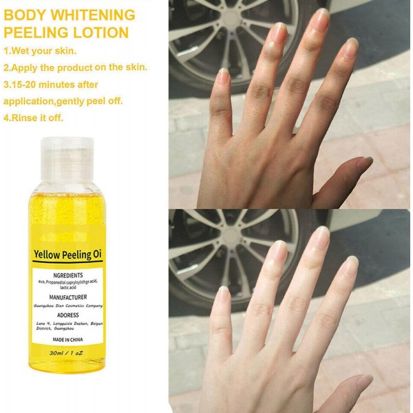 زيت تقشير الجلد الميت السحري