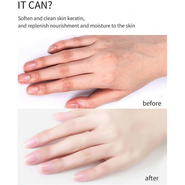 زيت تقشير الجلد الميت السحري