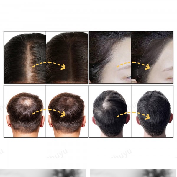 بودرة لتكثيف وإخفاء فراغات الشعر للرجال والنساء