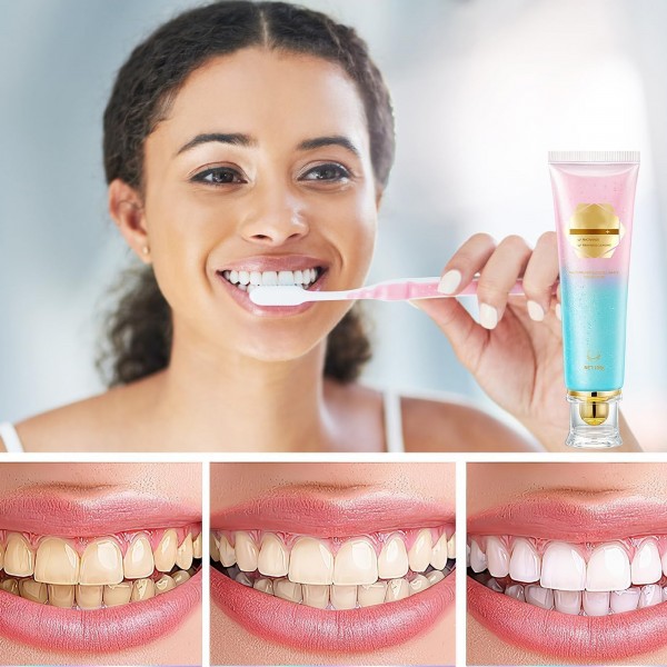 مبيض الاسنان الطبي بالنياسيناميد والنعناع