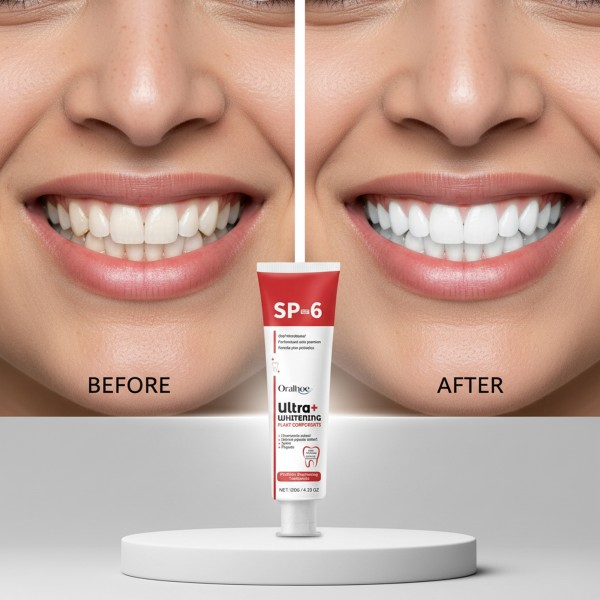 SP6 - المعجون الأسرع و الأقوى لتبييض الأسنان