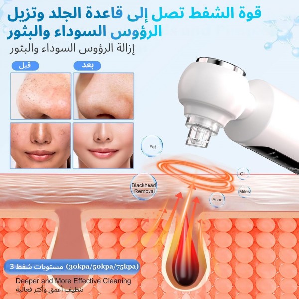 جهاز إزالة الرؤوس السوداء وشفط المسام مع 3 مستويات من الشفط