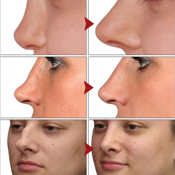 زيت لرفع الأنف وزيادة  الكولاجين وترطيب البشرة