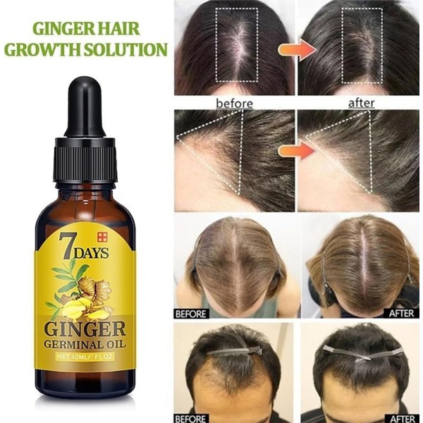 المصل المعجزة لنمو الشعر في 7 أيام