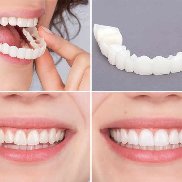 جهاز تصحيح وتجميل الاسنان