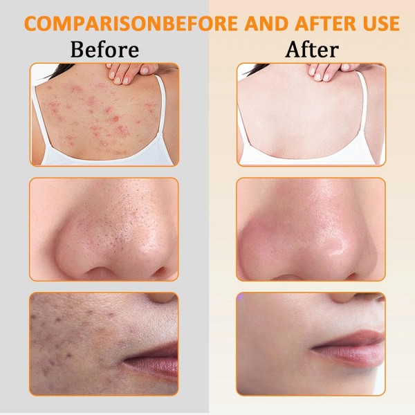 صابون حمض الكوجيك الكوري