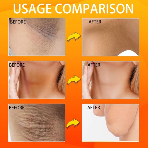 صابون حمض الكوجيك الكوري