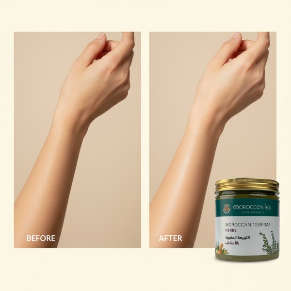 التبريمة المغربية بالأعشاب