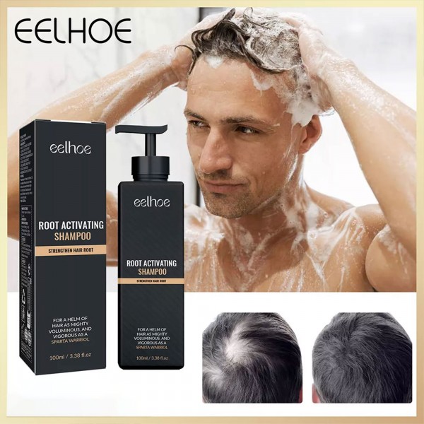 شامبو طبيعي ضد تساقط الشعر