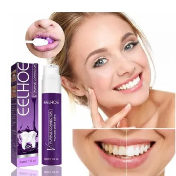 باقة الابتسامة الماسية 360 - فرشاة U الأوتوماتيكية بالذبذبات الصوتية + جل التبييض الفوري من ELLHOE